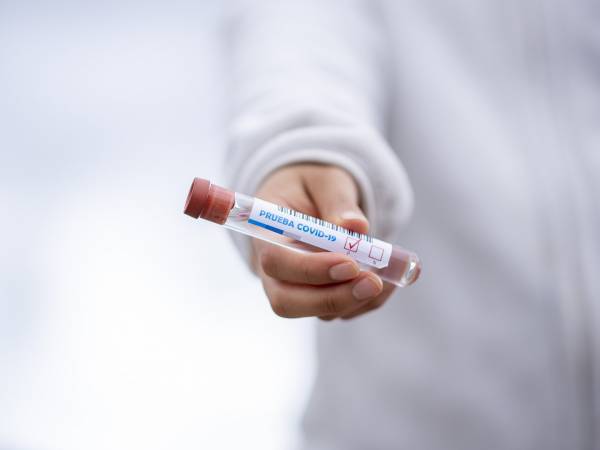Test na COVID-19 - rejestracja online